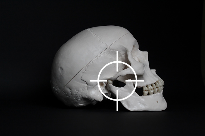 Manipolazioni per articolazione temporo mandibolare (ATM)