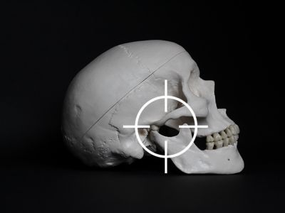 Manipolazioni per articolazione temporo mandibolare (ATM)